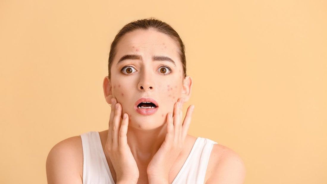 mat-na-tri-mun-va-kem-tri-mun-dung-cai-nao-khi-da-dang-sung-do