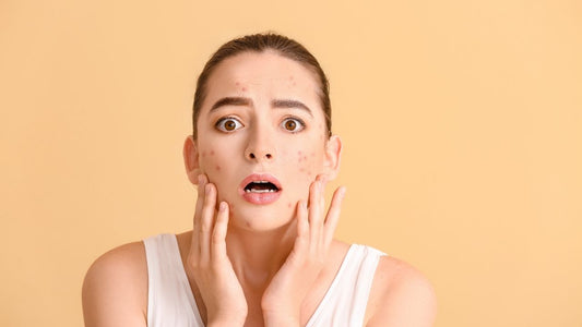 mat-na-tri-mun-va-kem-tri-mun-dung-cai-nao-khi-da-dang-sung-do