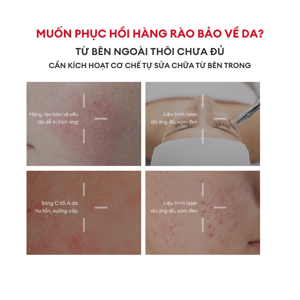 SERUM CẤP ẨM & PHỤC HỒI HÀNG RÀO BẢO VỆ DA
