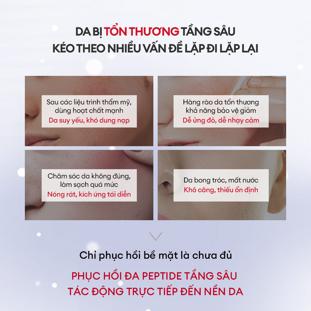 BỘT PEPTIDE ĐÔNG KHÔ VÀ DUNG DỊCH HOẠT HÓA PHỤC HỒI DA ĐA TẦNG