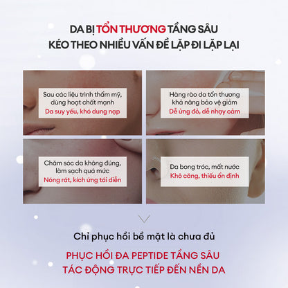 BỘT PEPTIDE ĐÔNG KHÔ VÀ DUNG DỊCH HOẠT HÓA PHỤC HỒI DA ĐA TẦNG