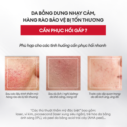 MẶT NẠ ĐÔNG KHÔ