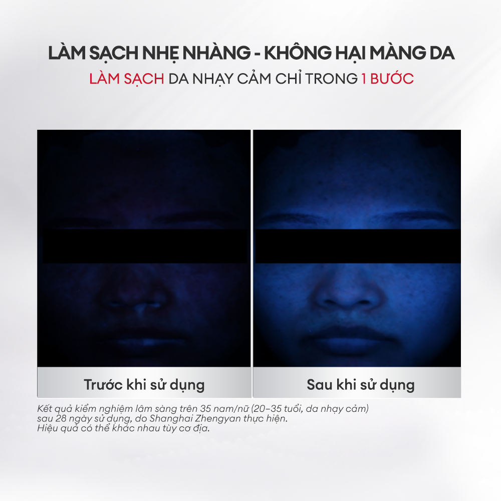 SỮA RỬA MẶT LÀM DỊU DA NHẠY CẢM