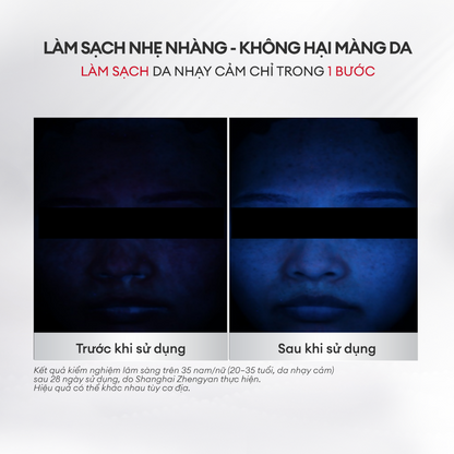 SỮA RỬA MẶT LÀM DỊU DA NHẠY CẢM
