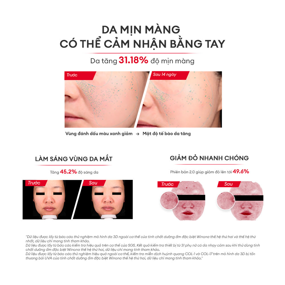 Tinh Chất Phục Hồi Dưỡng Ẩm Và Làm Dịu Winona