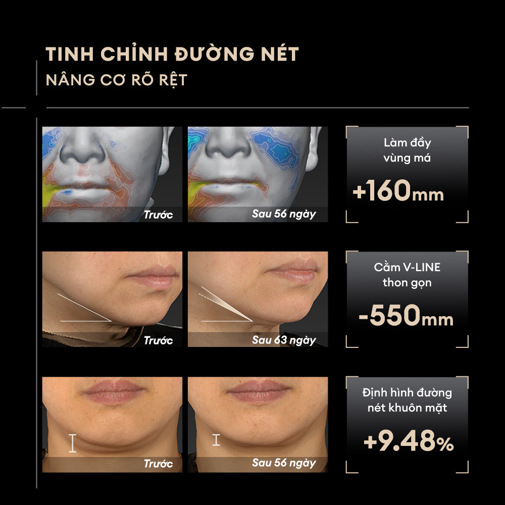 KEM DƯỠNG NÂNG CƠ
